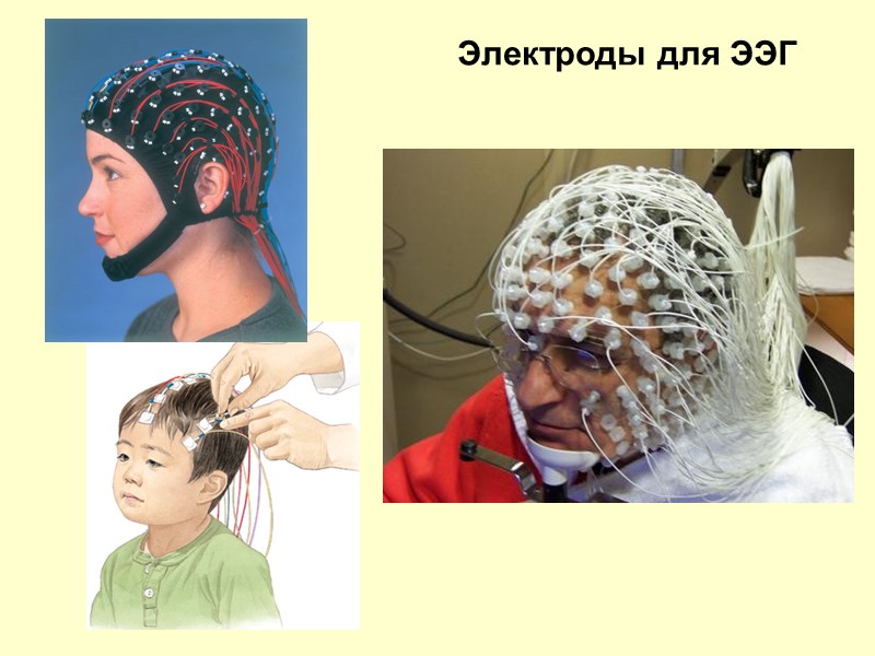 Электроды для ЭЭГ